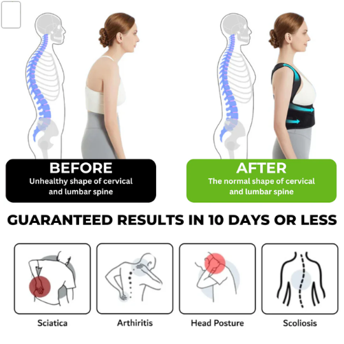 Adjustable Posture Corrector™